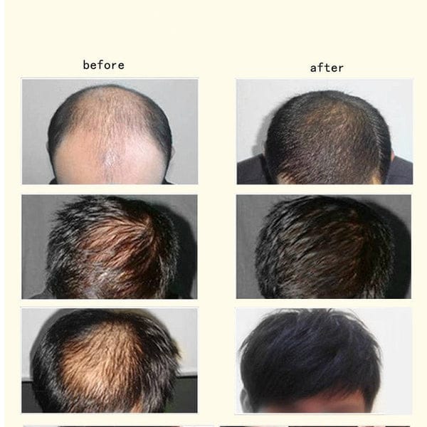 Ginger Anti-hair Loss Hair Maintenance 30ml